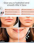 4-in-1 Facial Sculpting Mask | V-Line Lifting Device for Double Chin & Skin Tightening