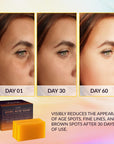 Kojic Acid Soap for Hyperpigmentation