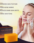 Kojic Acid Soap for Hyperpigmentation