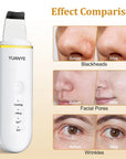 Skin Scrubber Face-Blackhead Remover