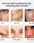 Led Face Mask - 7 Color Light Therapy for Anti-Aging, Acne & Wrinkles, Gift for Women