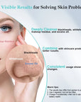 Skin Scrubber Face-Blackhead Remover