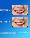 Teeth Whitening Kit 16X LED Light Rechargeable,Teeth Whitener
