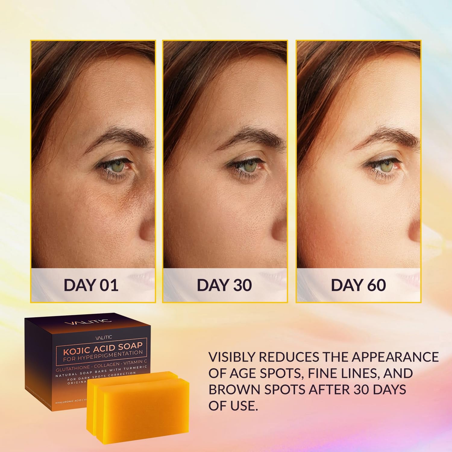 Kojic Acid Soap for Hyperpigmentation 