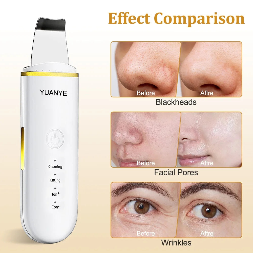 Skin Scrubber Face-Blackhead Remover 