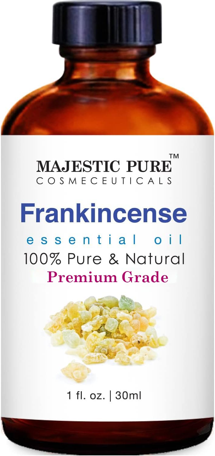 Frankincense Essential Oil – 100% Pure & Natural for Skin, Aromatherapy & Diffusers (1 oz)