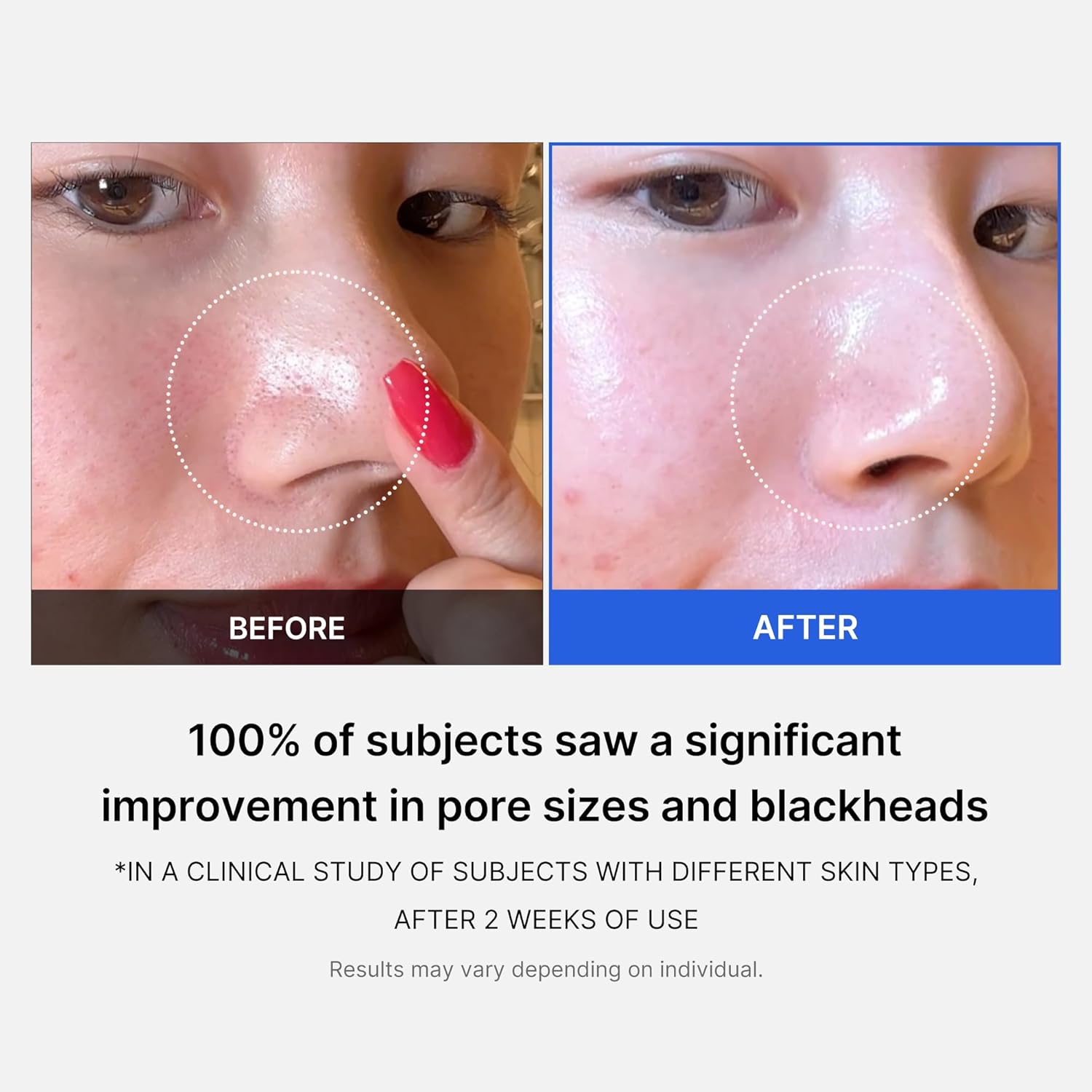 Zero Pore Pads-Textured Facial Toner Pads