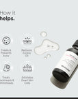 2% Salicylic Acid Serum for Acne, Blackhead & Open Pores 