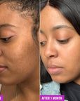 Glycolic Exfoliating Toner 