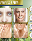 Retinol Body Lotion Moisturizer 