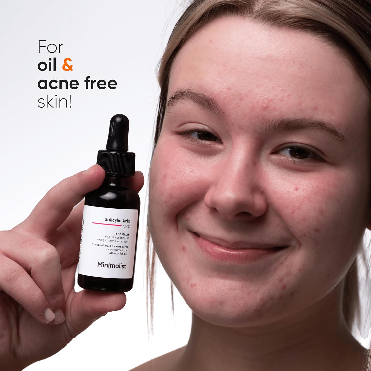 2% Salicylic Acid Serum for Acne, Blackhead &amp; Open Pores 
