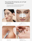 Electric Blackhead Remover Cleaner Face Diamond Pore Vacuum Suction White Heads