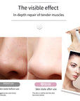 Electric Blackhead Remover Cleaner Face Diamond Pore Vacuum Suction White Heads