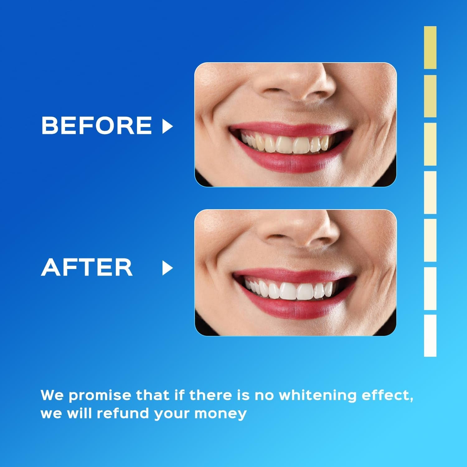 Teeth Whitening Kit 16X LED Light Rechargeable,Teeth Whitener 