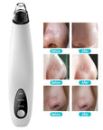 Electric Blackhead Remover Cleaner Face Diamond Pore Vacuum Suction White Heads